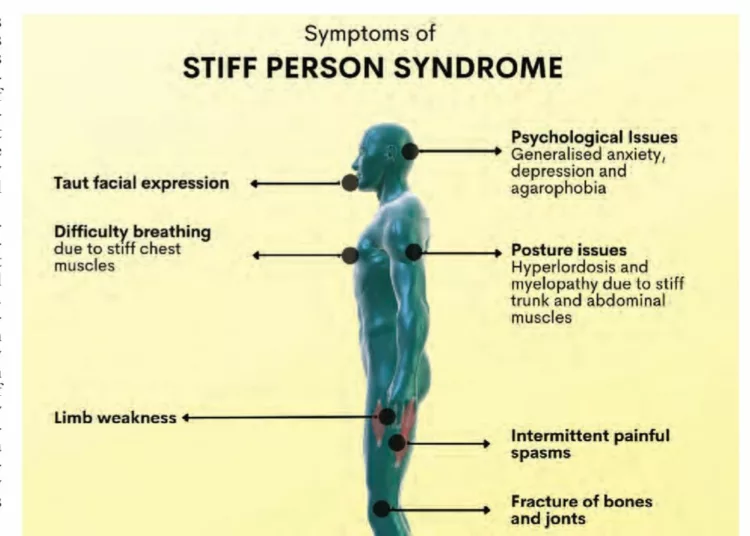 Stiff-Person Syndrome